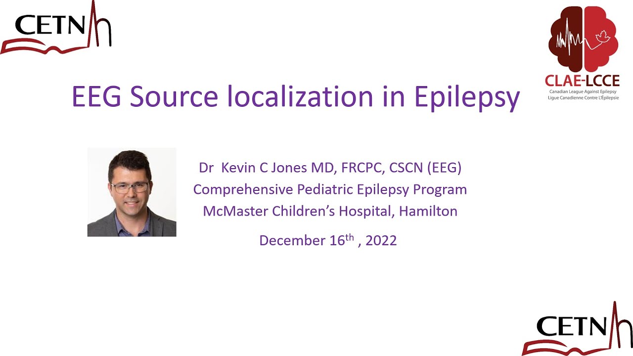 CETN Rounds: EEG Source Localization in Epilepsy by Dr Kevin Jones