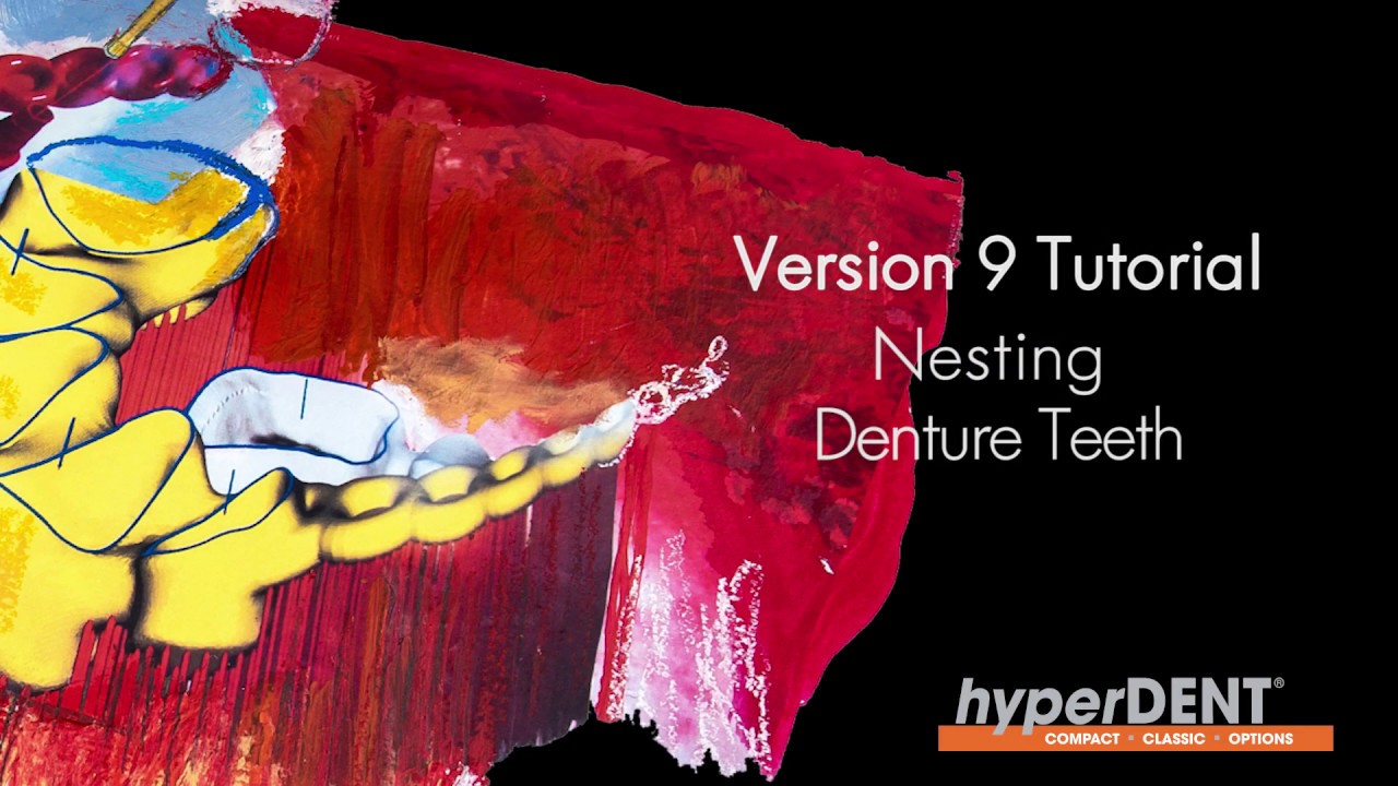 hyperDENT V9 Tutorial:  Nesting Denture Teeth