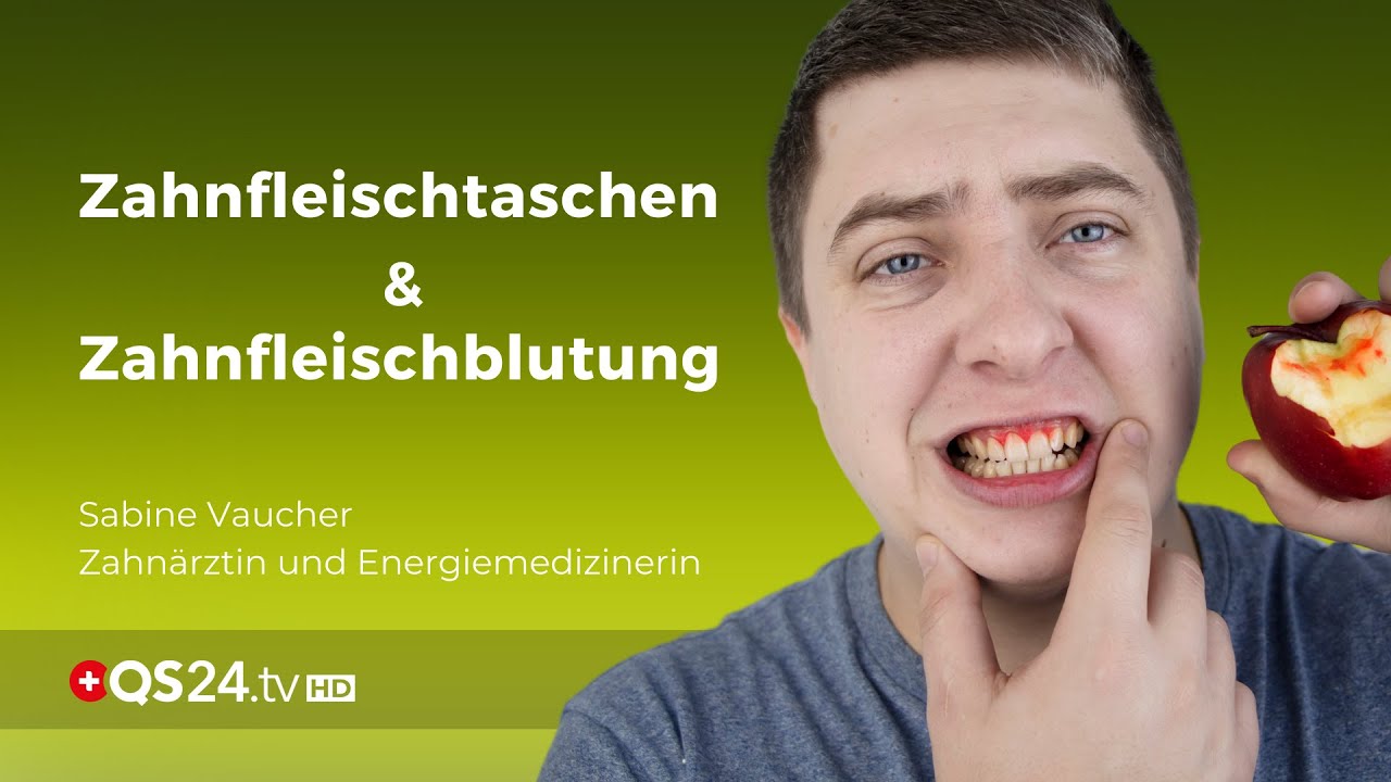 Zahnfleischtaschen und Zahnfleischblutungen | Zahnärztin Sabine Vaucher | NaturMEDIZIN | QS24