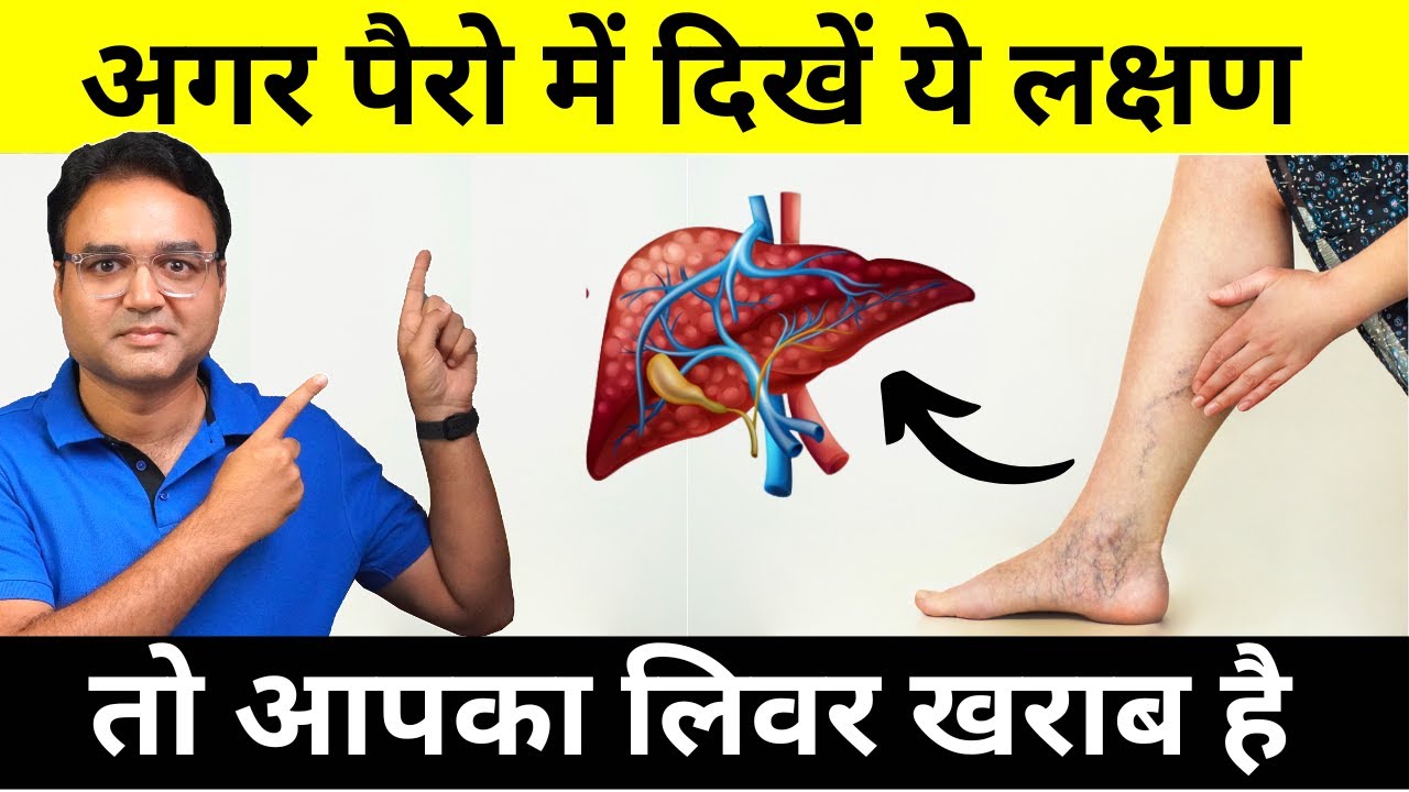 Never Ignore These 9 Warning Signs Of Liver Disease That Come In Your Feet | Healthy Hamesha