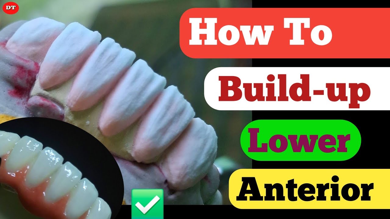 How To Build up Lower Anterior| Ceramic Layering| Dental Videos| Dental Lab| how to Layering Ceramic
