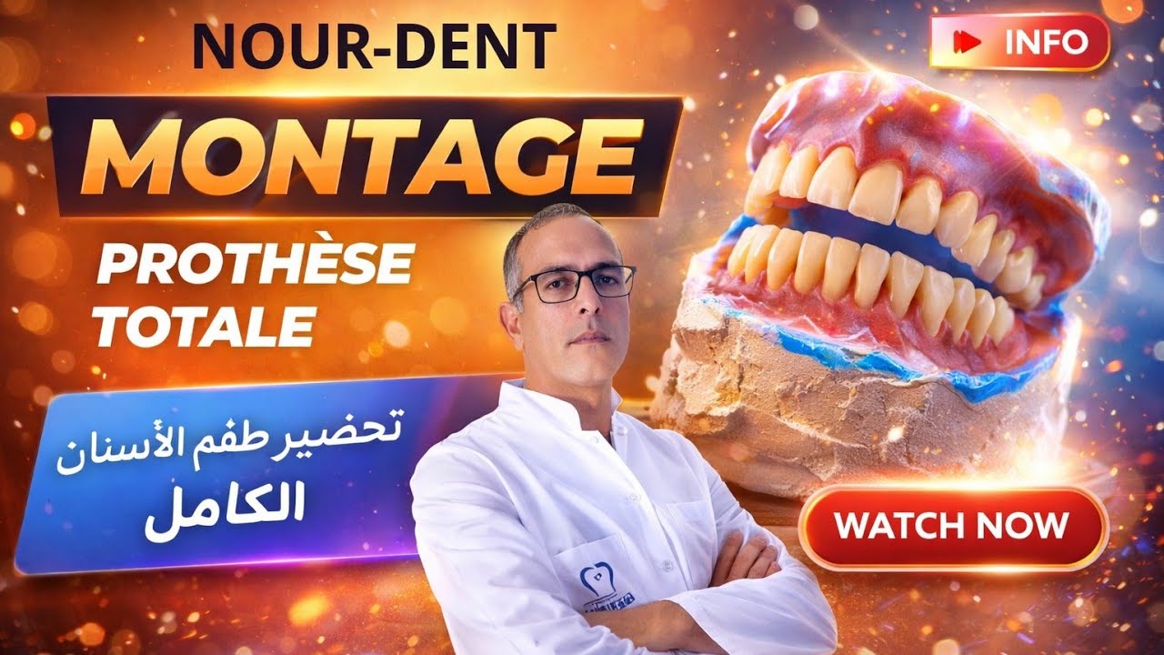 Montage prothèse totale تحضير طقم الاسنان الكامل