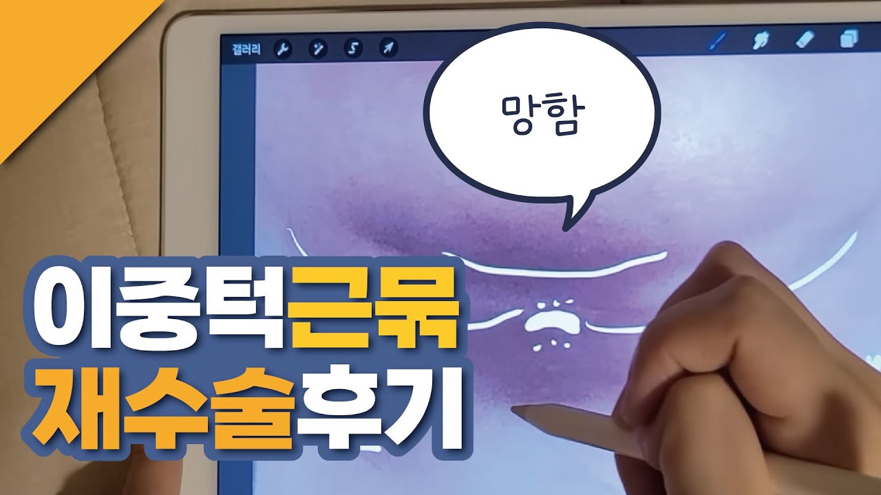 | 이중턱 근육묶기후기| 1차수술실패·2차재수술·누운3자라인·뱀물린흉터·티라노사우르스