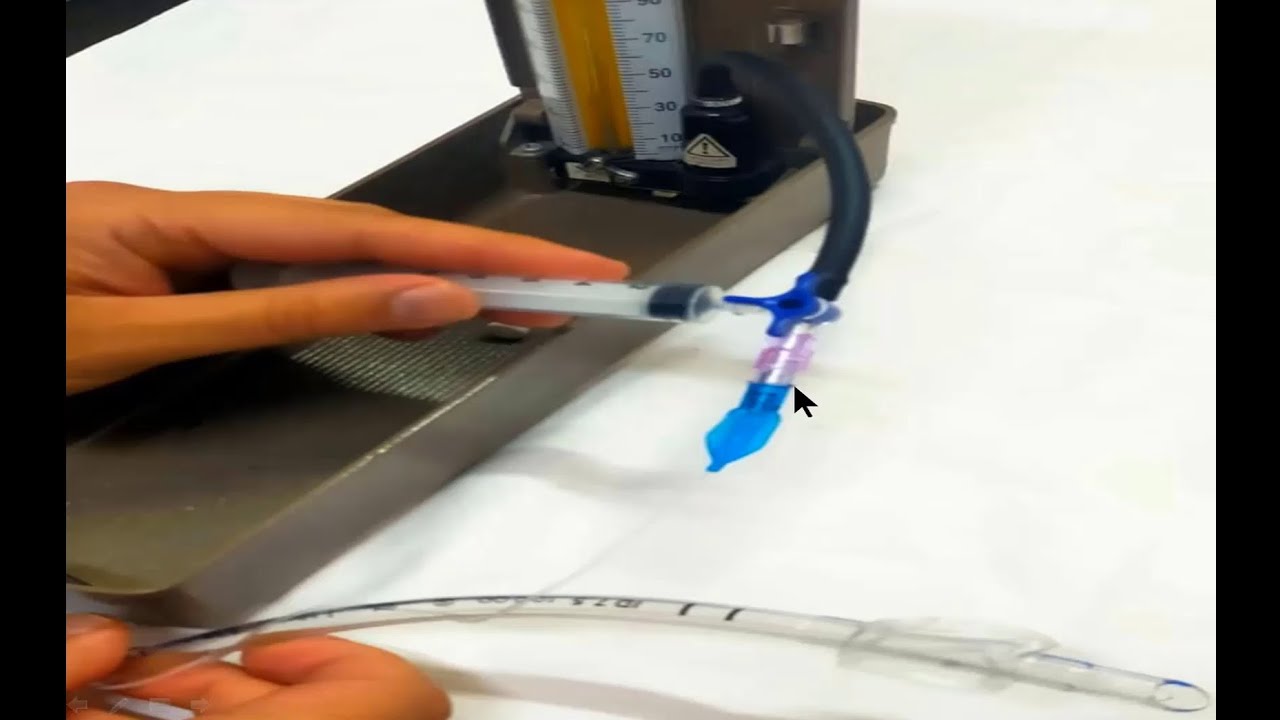 Endotracheal tube cuff pressure