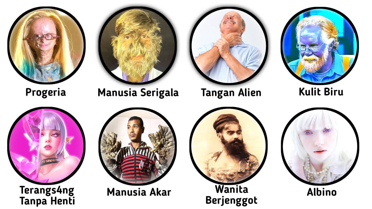 Kasus Medis Paling Aneh Dijelaskan Dalam 9 Menit (Part 2)