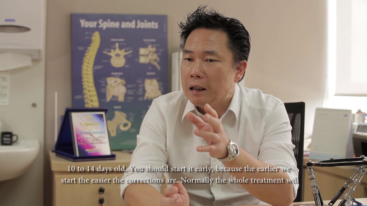 When does a child with club foot typically receive treatment?