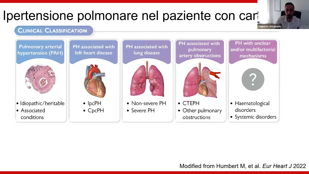 JC The right heart in patients with cancer  A scientific statement of the Heart Failure Association
