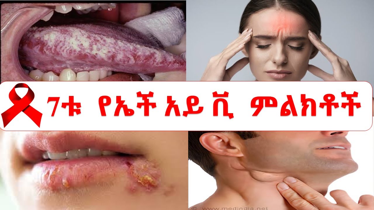 በተያዝን ሁለት ወር ዉስጥ የሚታዩ 7ቱ የኤች አይ ቪ ምልክቶች// early HIV signs