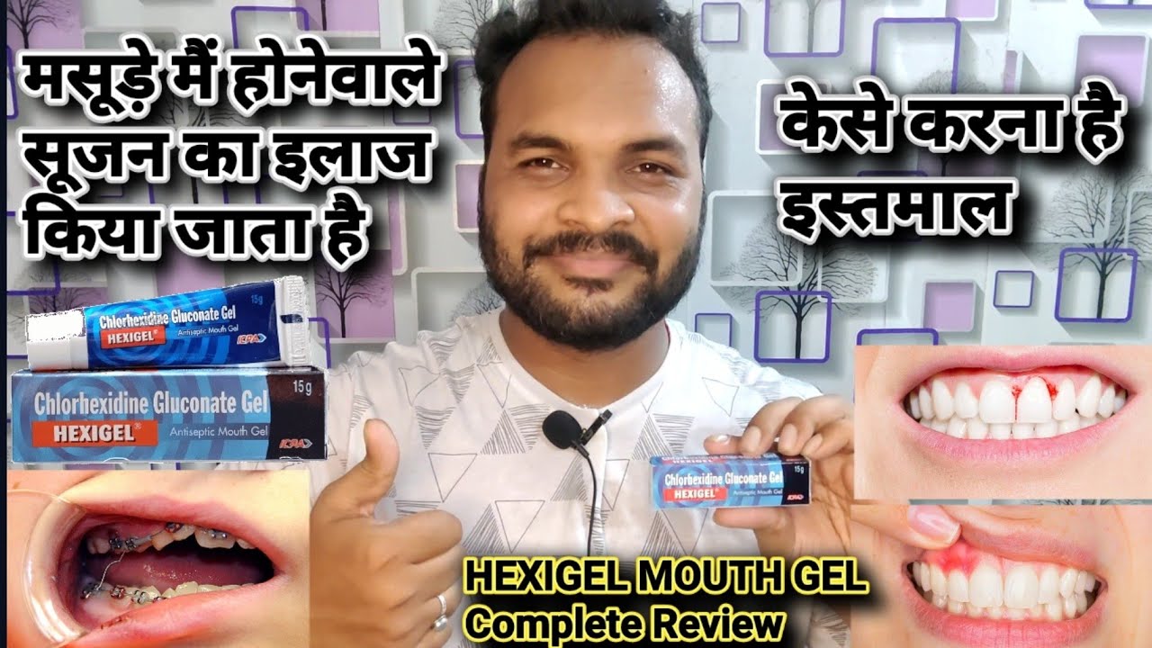 HEXIGEL ANTISEPTIC MOUTH GEL TREATMENT FOR INFLAMATION OF GUM AND MOUTH ULCER || COMPLETE REVIEW