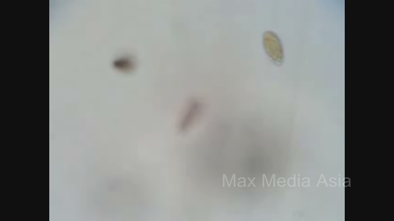 Red Tide Microscopic Chattonella Marina Subrahmanyan organisms