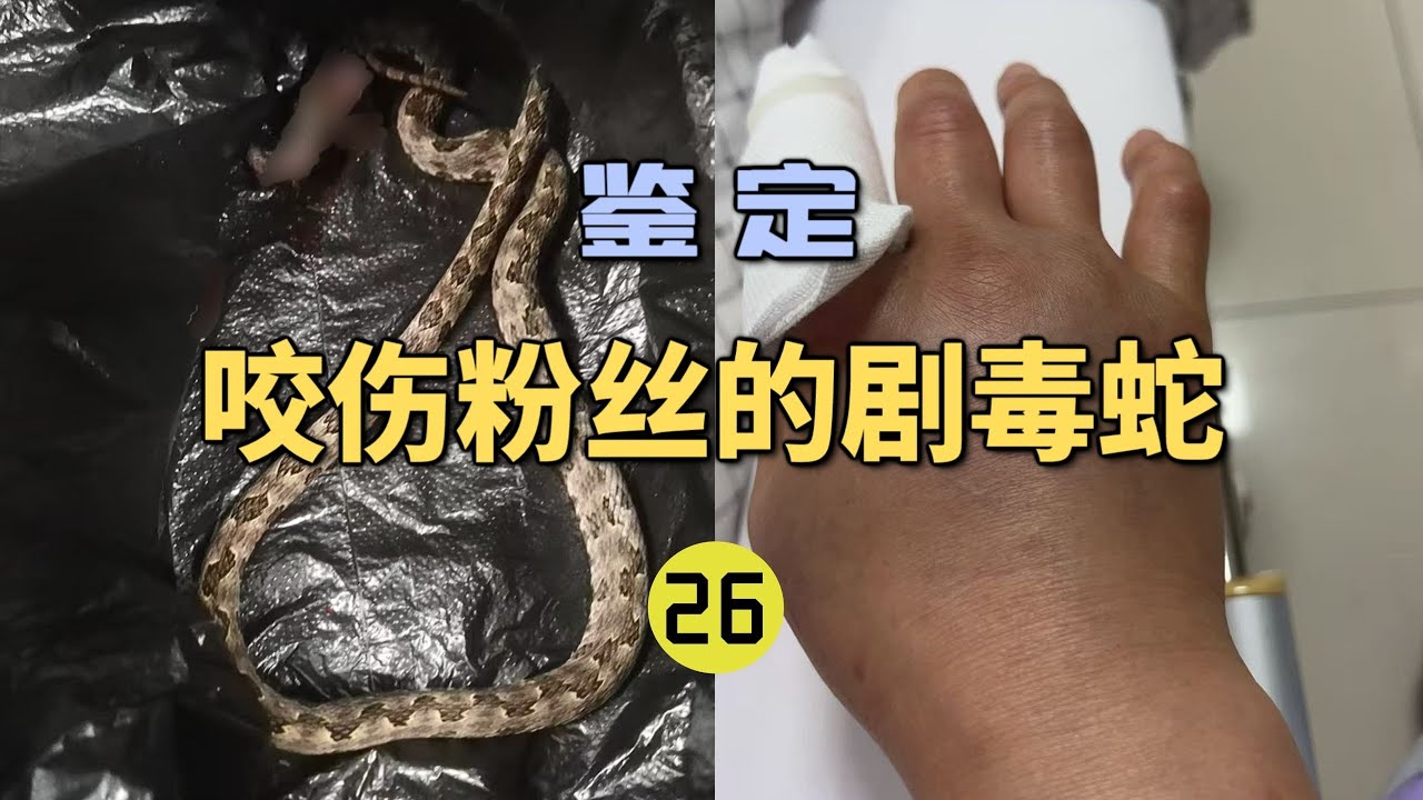 4K | 鉴定咬伤粉丝的毒蛇（26）粉丝的家人被不明毒蛇咬伤？痛的哇哇叫！【世界记忆大师龙雅】
