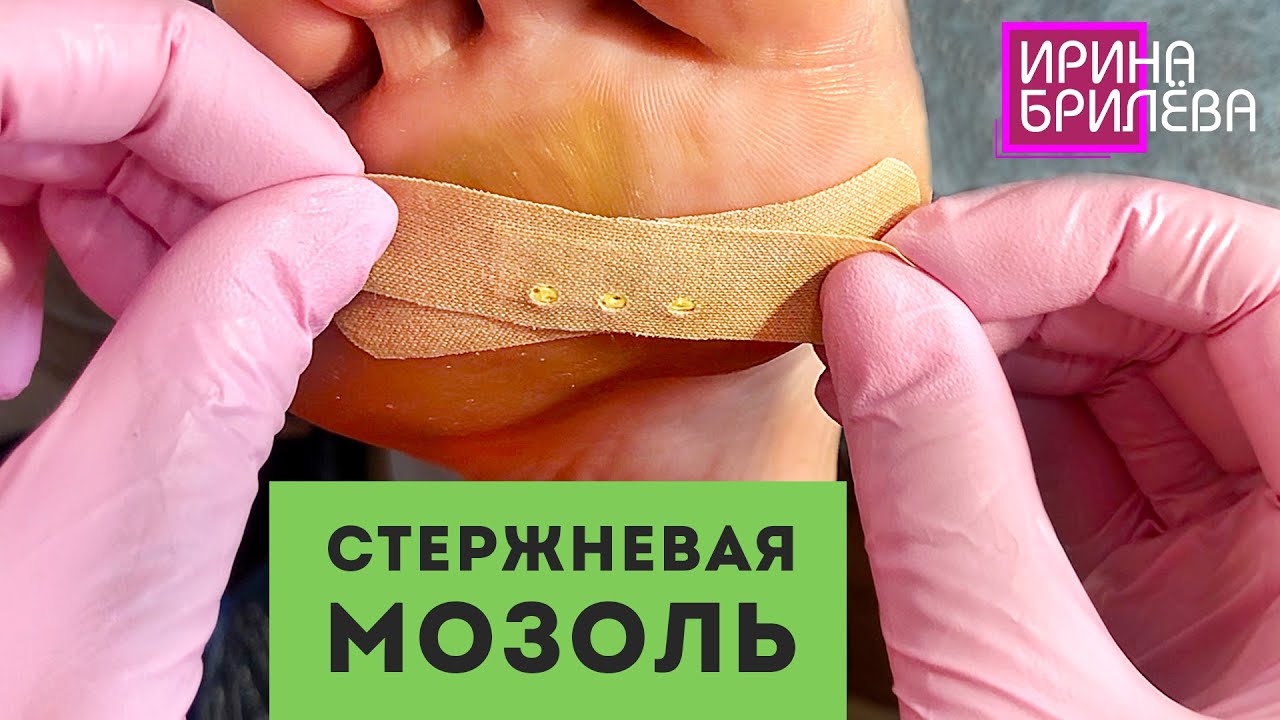 Убираем СТЕРЖНЕВУЮ МОЗОЛЬ 🌸 Эстетический ПЕДИКЮР 🌸 Ирина Брилёва