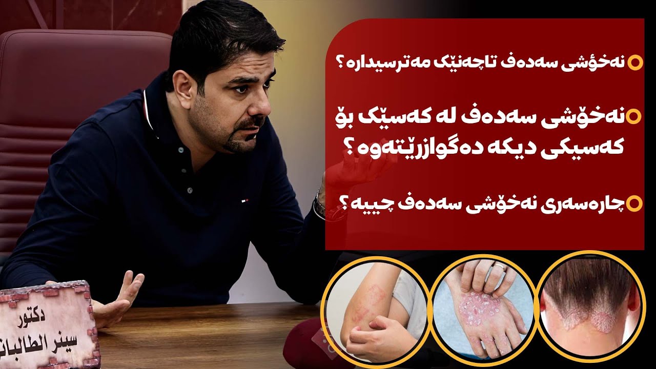 🔶نەخۆشی سەدەف تا چەنێک مەترسیدارە ؟
