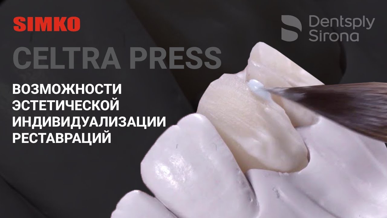 Стеклокерамика CELTRA PRESS | Возможности эстетической индивидуализации реставраций