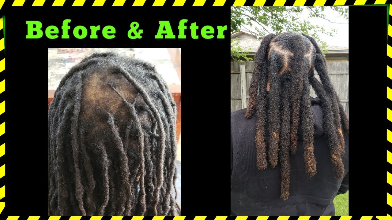 Locs to Wicks: Bald Spot Coverage! *FAQ's Answered in Description*