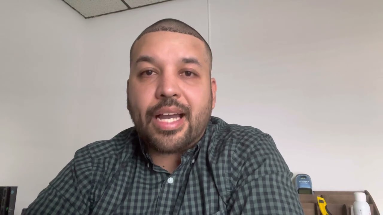HMR Tijuana 1500 graft hair transplant . Week 1