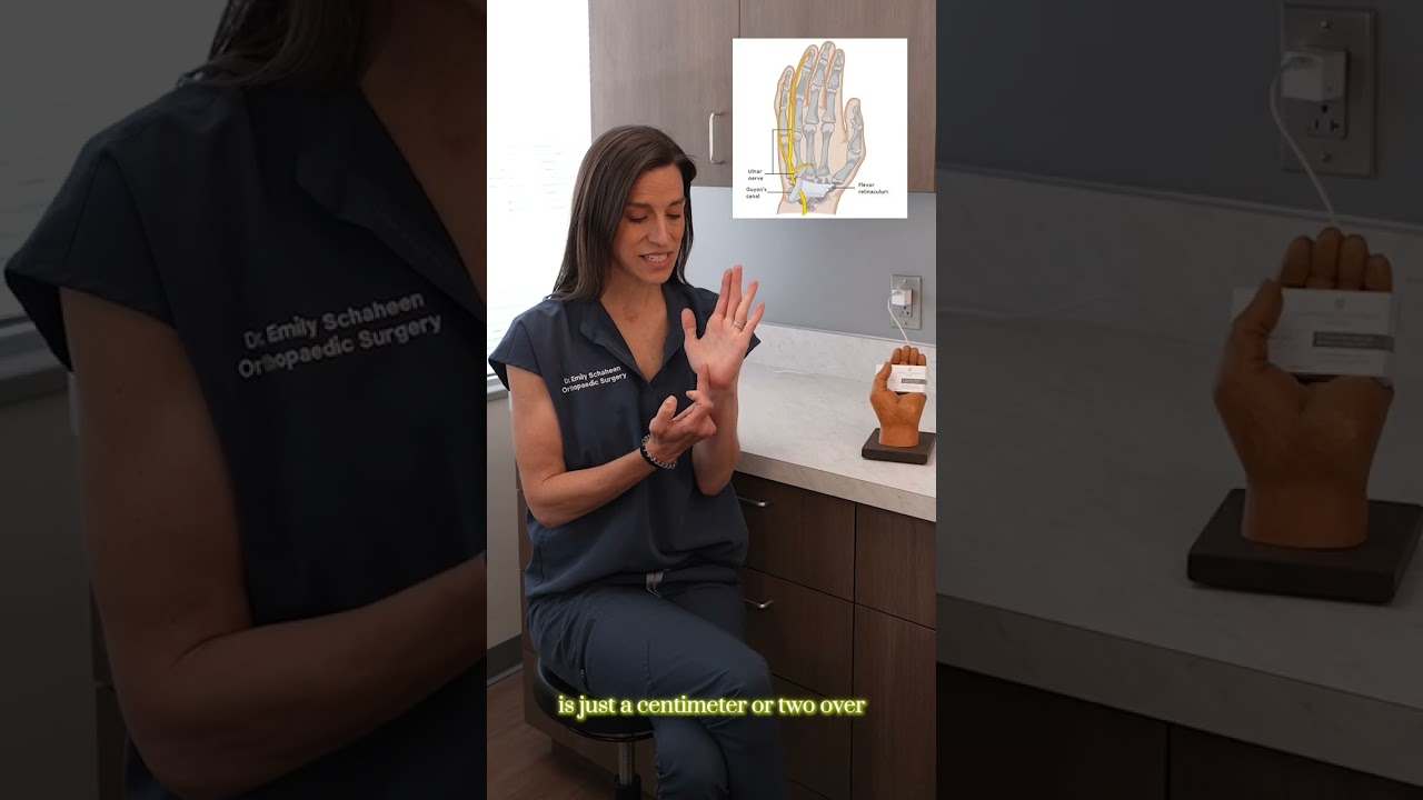 The Difference Between Carpal Tunnel and Guyon's Canal