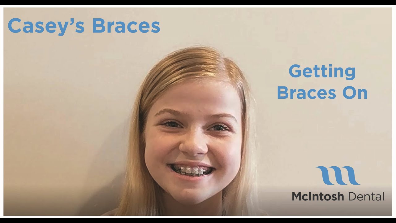 Getting Braces On: The Big Day!