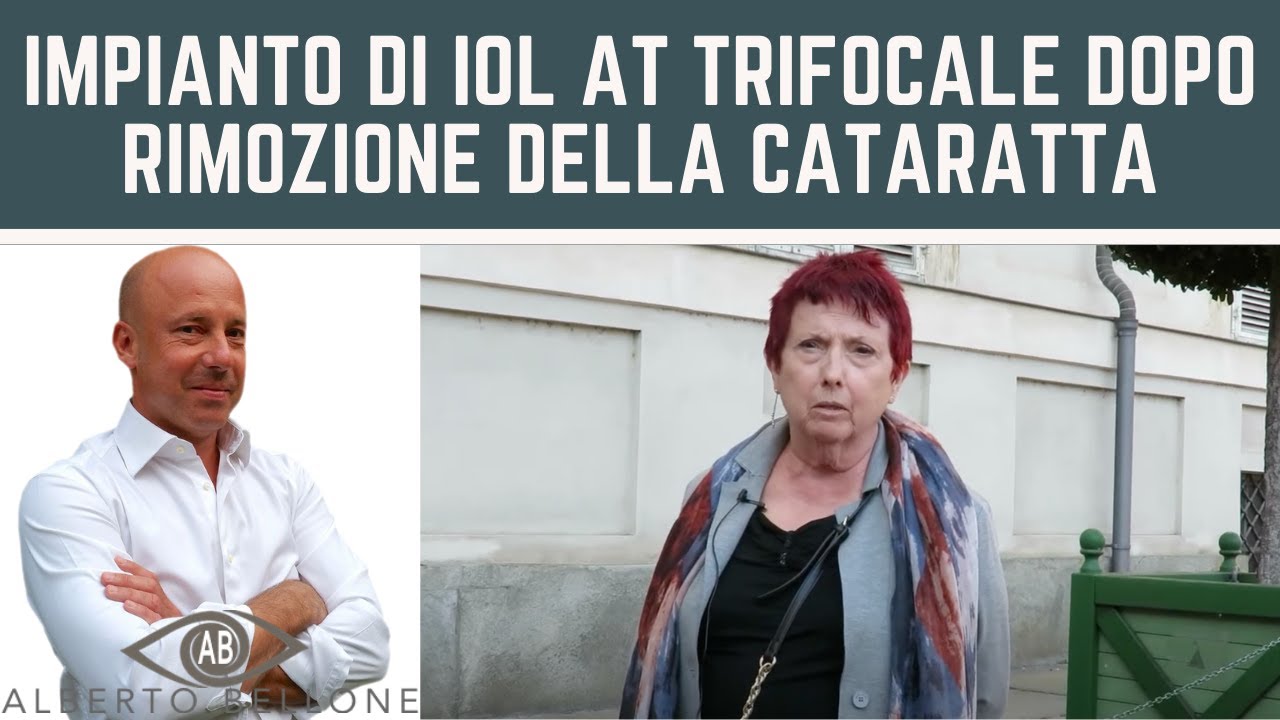 Impianto di IOL AT Trifocale dopo rimozione della cataratta
