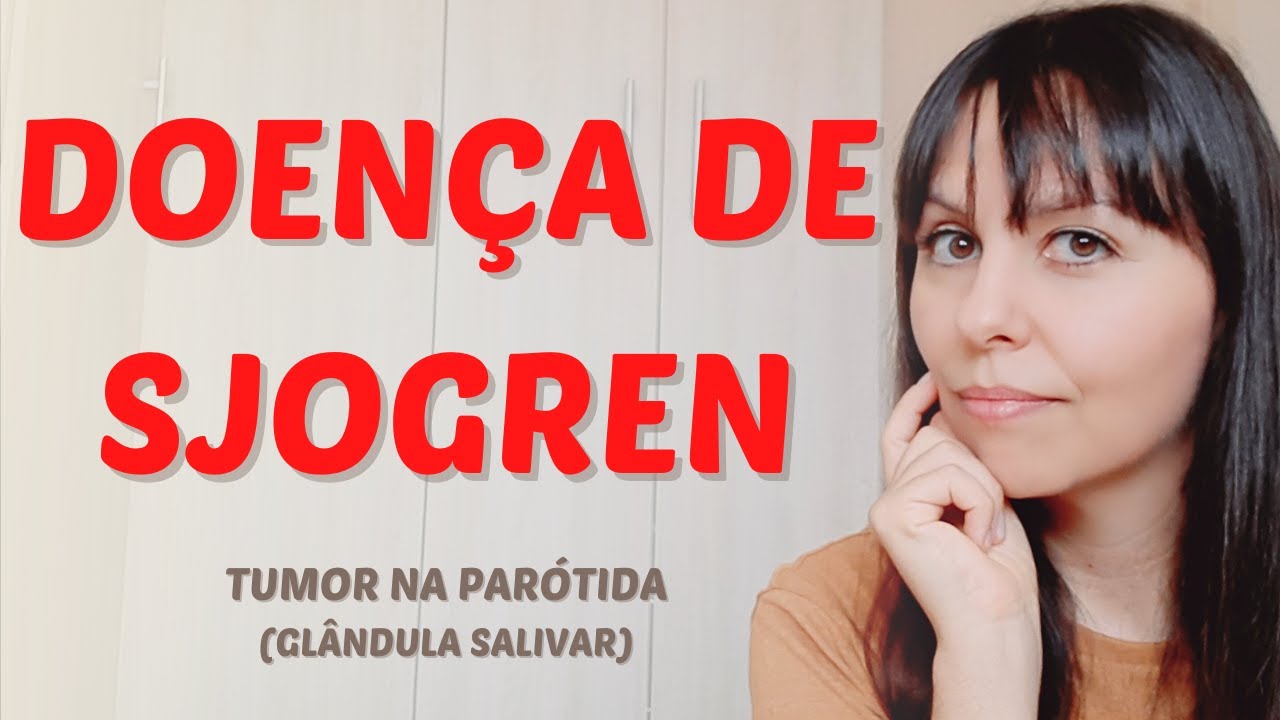 Doença de Sjogren / Síndrome de Sjogren