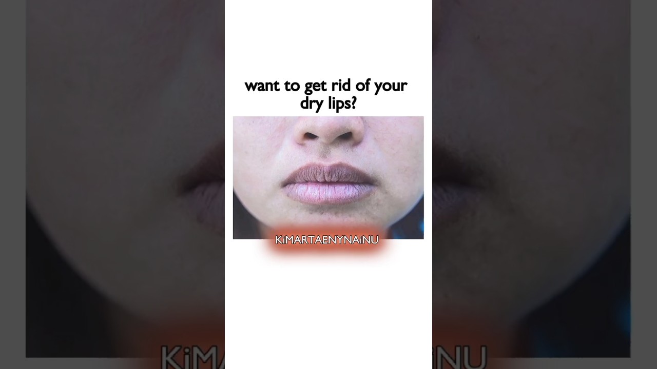 do you want to get rid of your dry lips?👄~💗#shorts#viral #lipscare #trending #glowup #fypシ#aesthetic