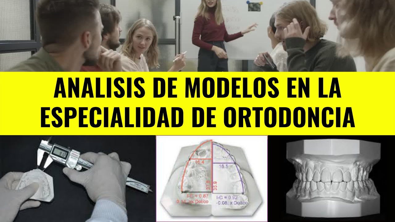 ANALISIS DE MODELOS EN LA ESPECIALIDAD DE ORTODONCIA