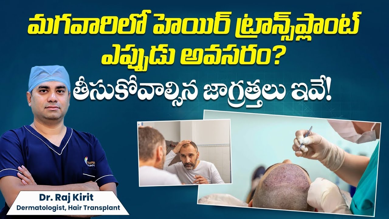 When to Get Hair Transplant for Men | Grades of Baldness Explained | Celestee Skin And Hair Clinic