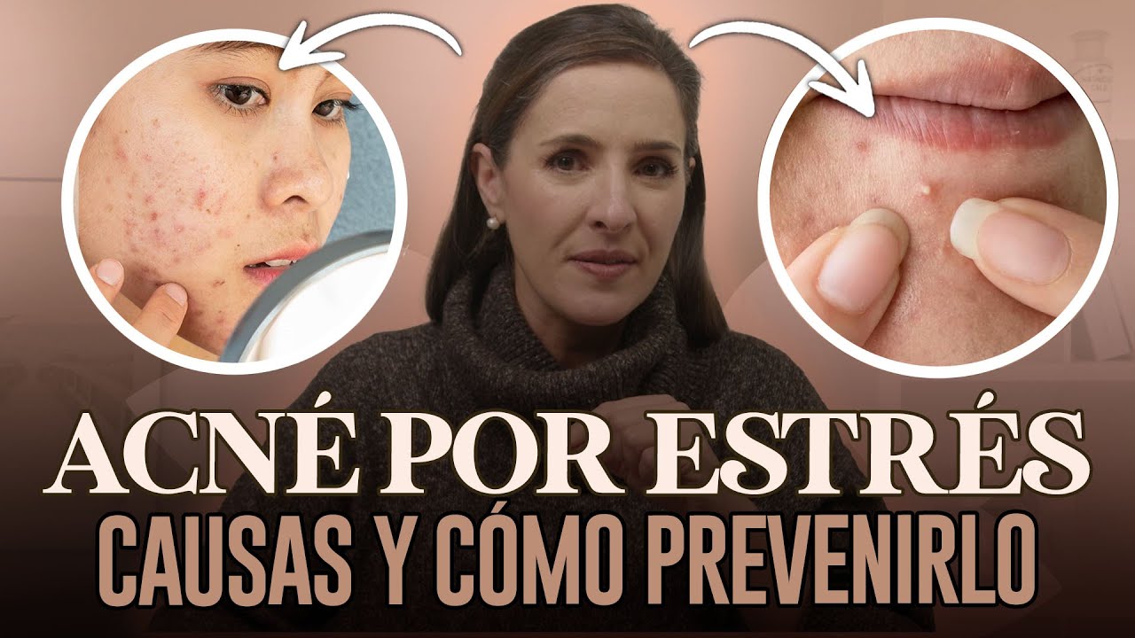 🔴 Así afecta el ESTRES a nuestra PIEL @drapilarochoa - Dermatologa