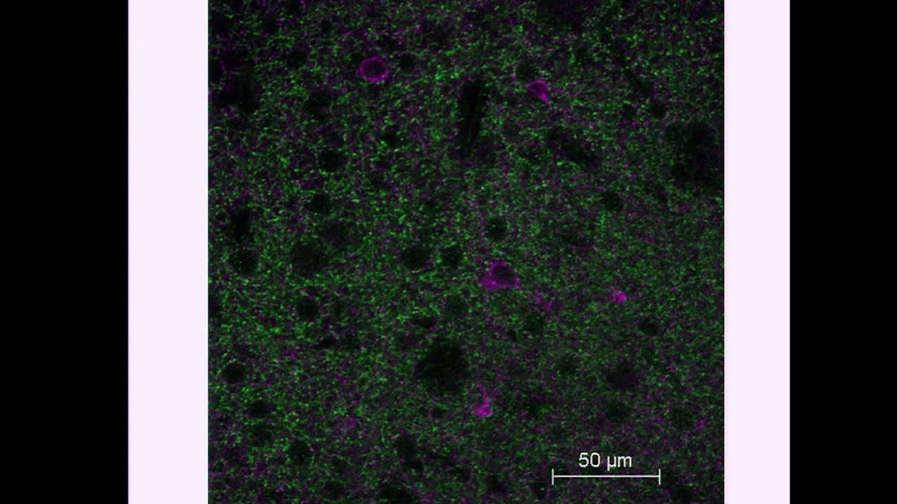 R. Mark Wightman: Electrochemical  Monitoring of Neurotransmitters and Metabolites