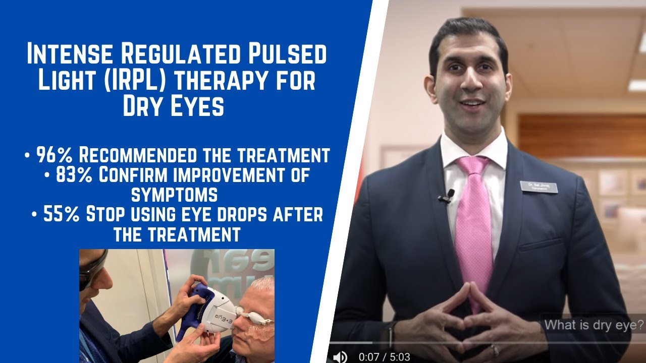 Intense Regulated Pulsed Light (IRPL) therapy for dry eyes