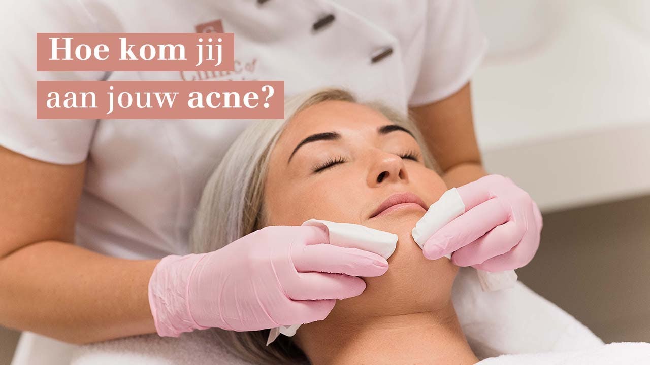 Hoe kom jij aan jouw acne? | Huidtherapeut Wendy | Clinic of Skin