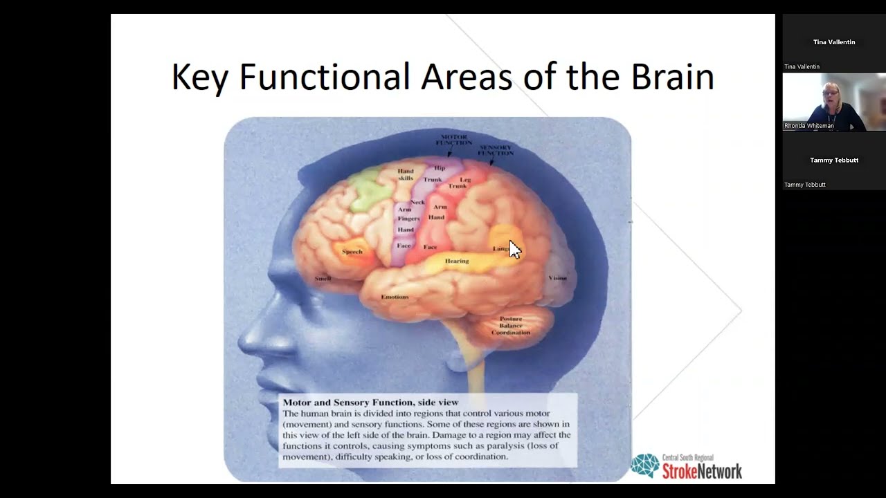 Stroke 101 - Neuroanatomy & Stroke Syndromes Review (Apr. 26, 2023)