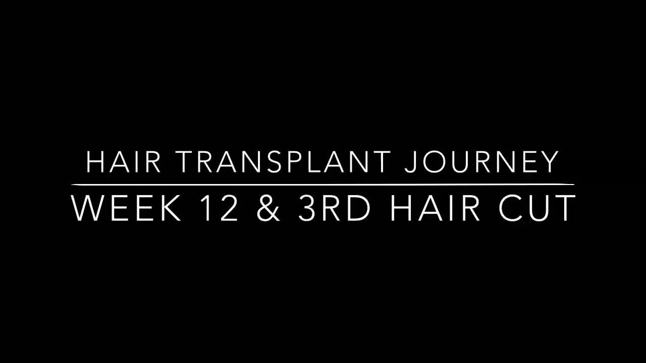 HAIR TRANSPLANT JOURNEY - WEEK 12 - HLC Ankara
