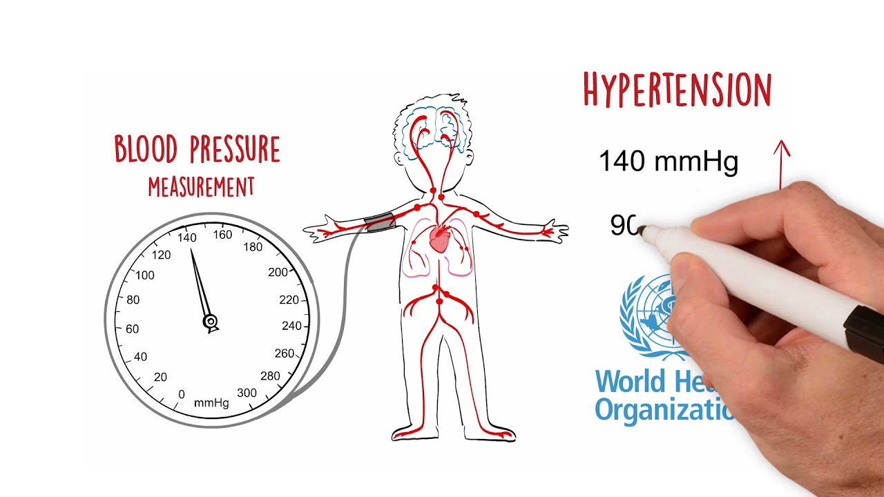 World Heart Federation Roadmap for Hypertension - 2021 Update
