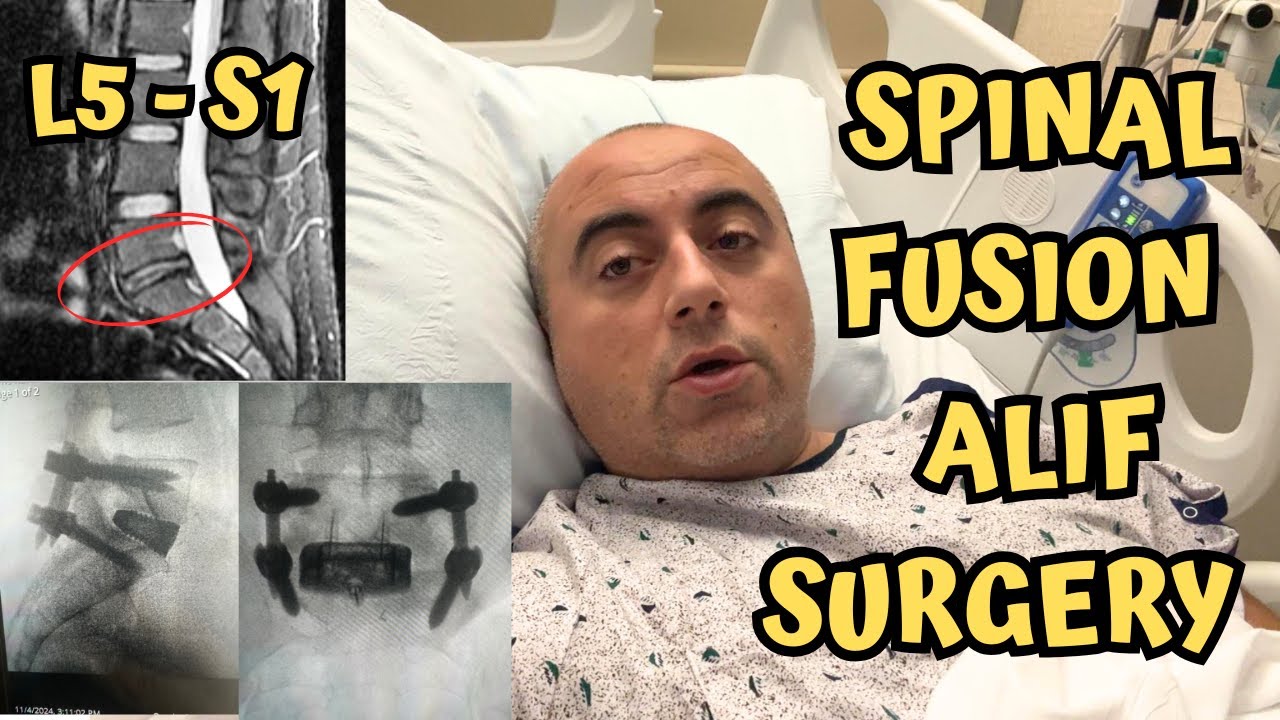 My Hospital Stay for L5-S1 Spinal Fusion Surgery - ALIF