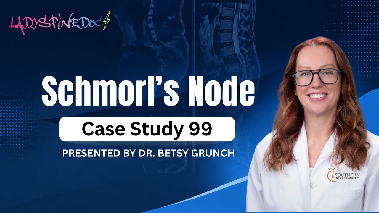 Case study 99 - Dr. Grunch explains diagnosis and treatment of Schmorl&rsquo;s node