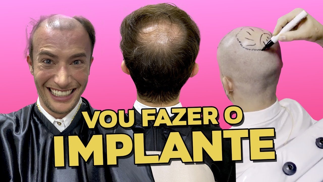 Cansei de ser calvo! - A FARSA DA BLOGAYRA CARECA Ep. 2 #shorts | Maicon Santini