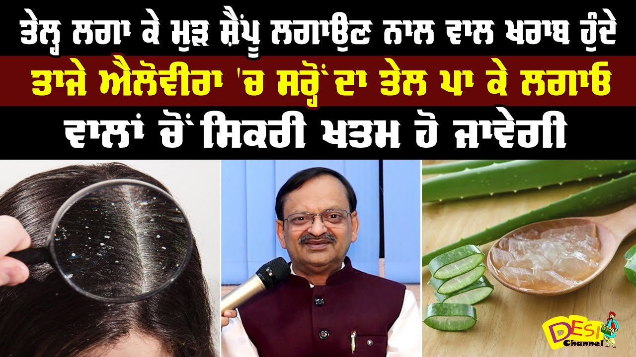 Hair Dandruff & Hair Fall Problem Treatment Subhash Goyal | Ayurvedic Home Remedies Subhash Goyal |