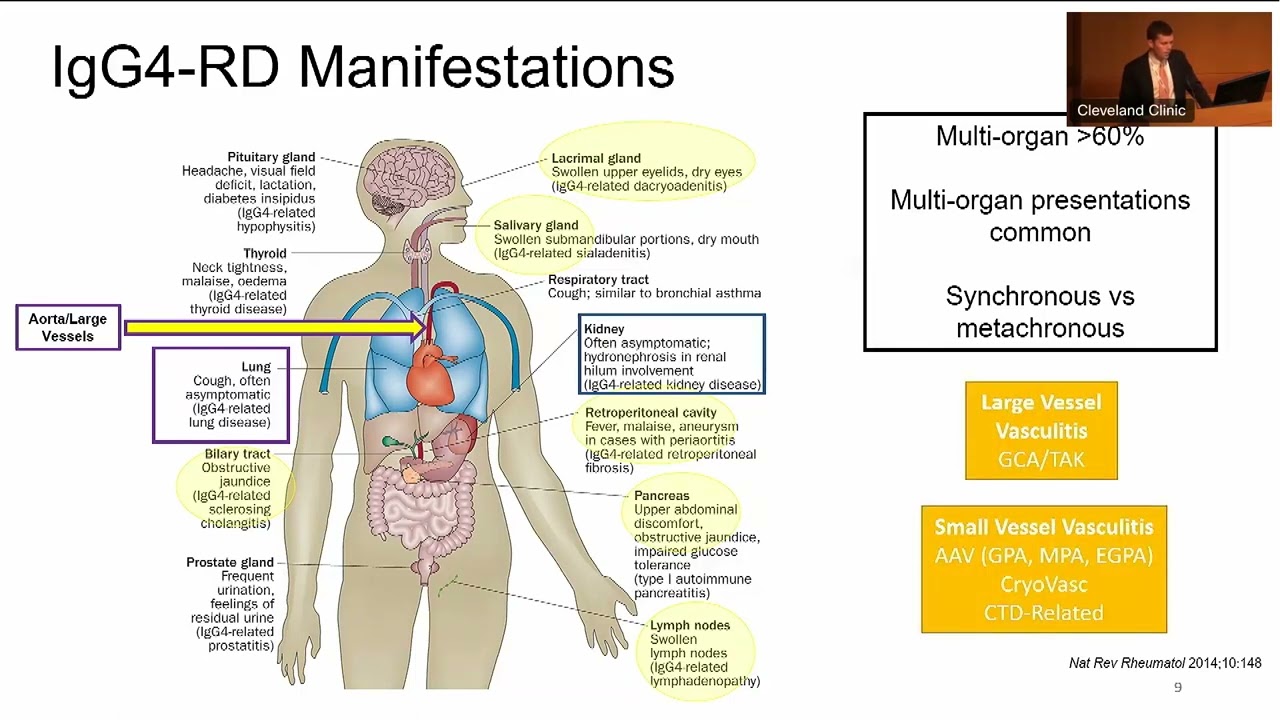 Key Issues in the Differential Diagnosis of Vasculitis