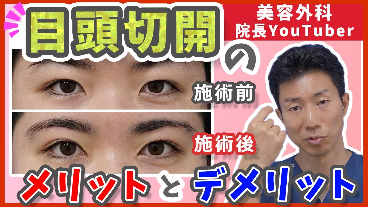 【目頭切開】傷跡って残る？目頭切開のメリット・デメリットを徹底解説
