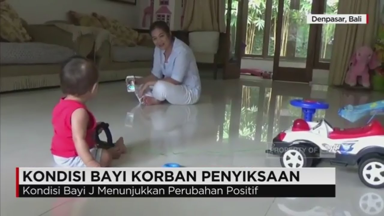 Kondisi Bayi J Korban Penyiksaan Membaik