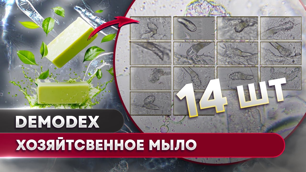 🔬 Хозяйственное мыло против Демодекса – выживет ли клещ?