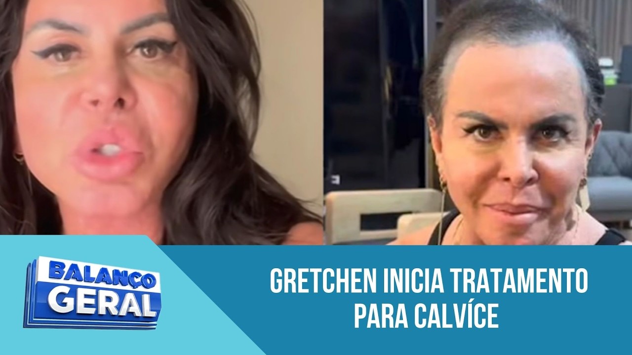 Gretchen inspira mulheres ao abordar alopecia nas redes | ' A Hora da Venenosa'