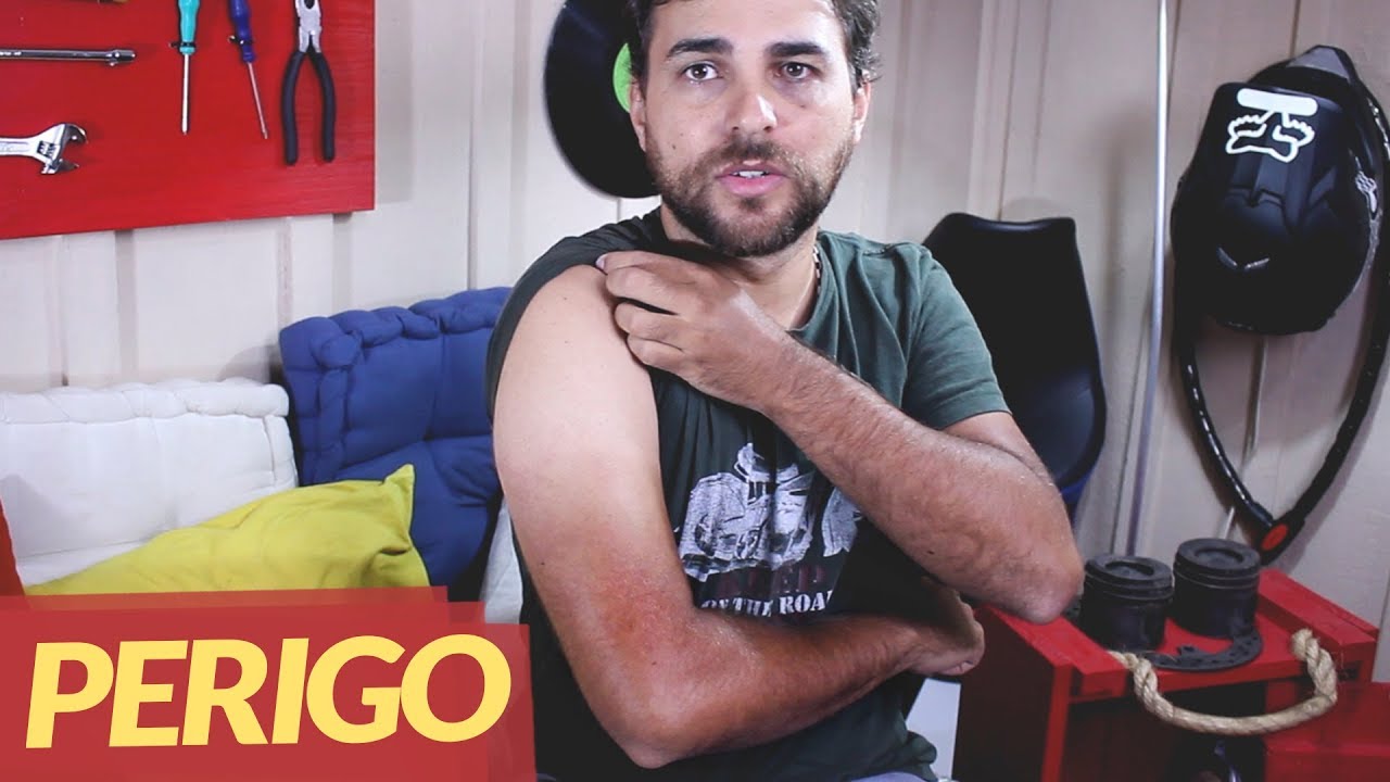 O SEU BRAÇO ESTA ASSIM? SAIBA COMO SE PROTEGER