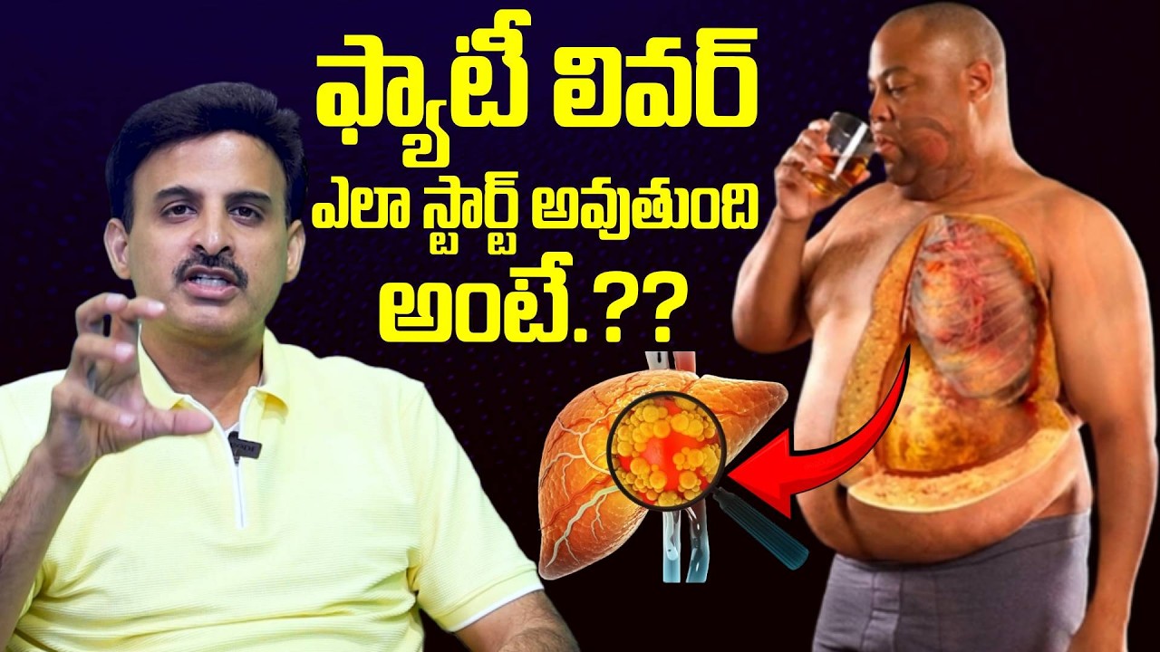 ఫ్యాటీ లివర్ ఎలా స్టార్ట్ అవుతుంది అంటే.?? | Fatty Liver Causes And Symptoms | Dr Ravikanth