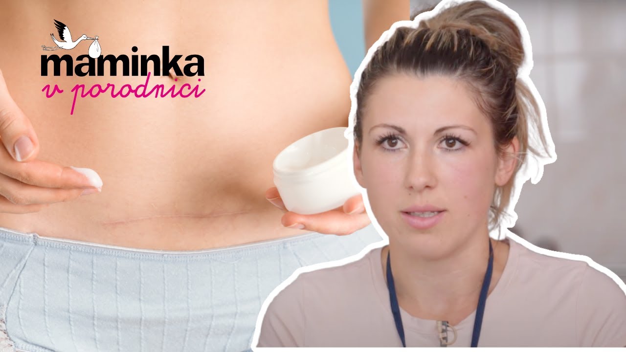 Jak se starat o jizvu po c&iacute;sařsk&eacute;m řezu? Praktick&eacute; tipy m&aacute; porodn&iacute; asistentka Iveta Strakov&aacute;