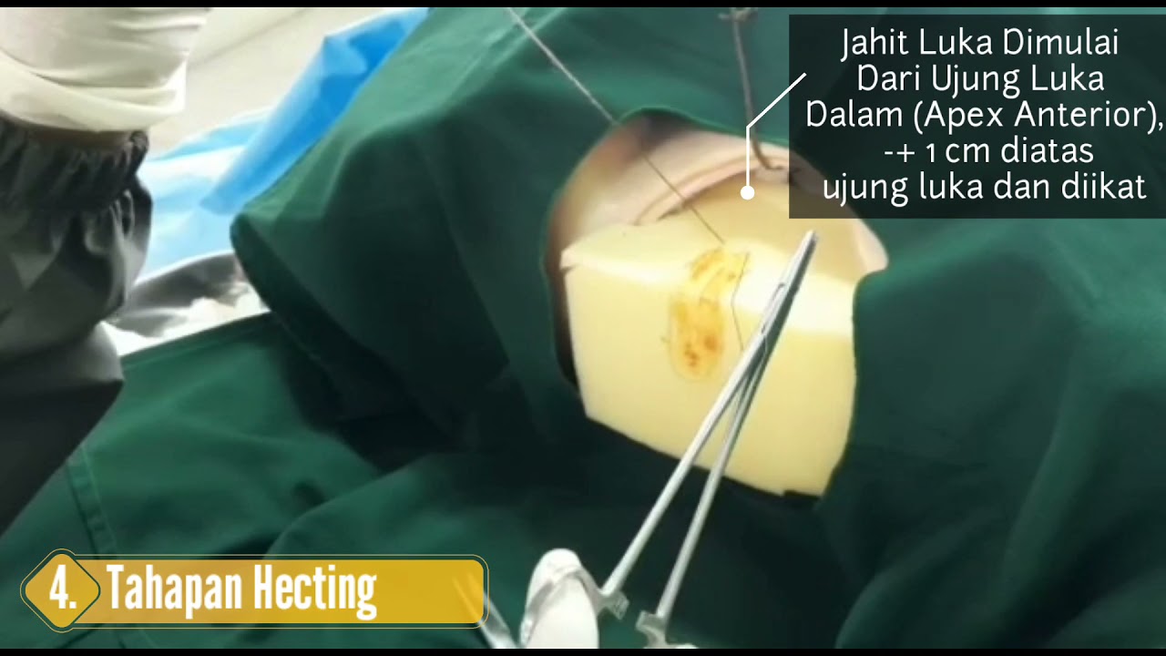 Praktikum Hecting Perineum | Fikes UIN Syarif Hidayatullah Jakarta