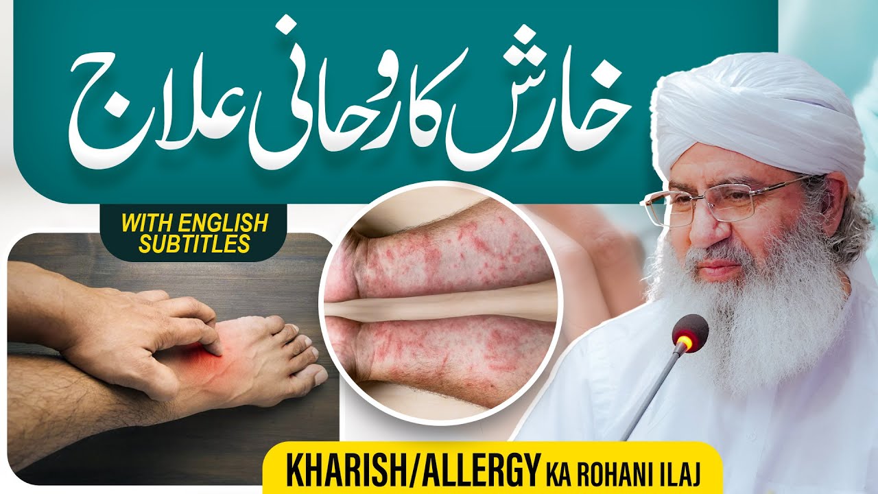 Kharish (Itch) Ka Rohani Ilaj | Kharish Khatam Karne Ka Tariqa | Haji Shahid Attari