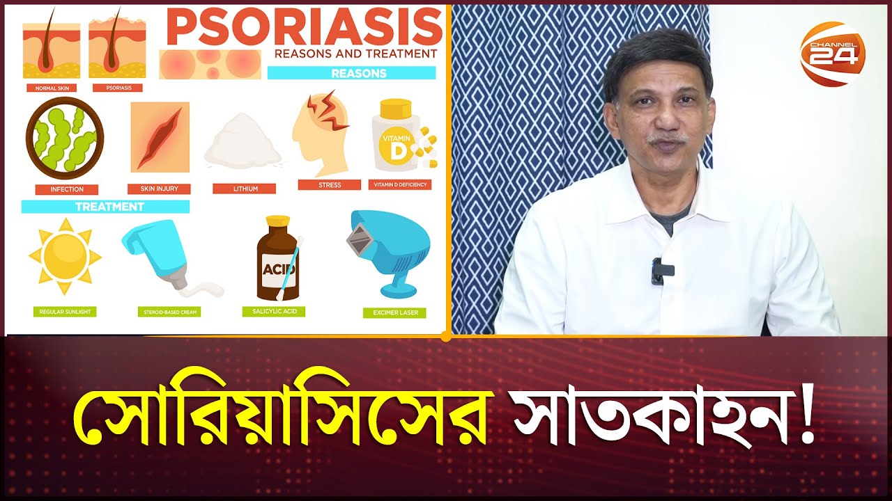 সোরিয়াসিসের সাতকাহন | Psoriasis | Health and Cure | Channel 24