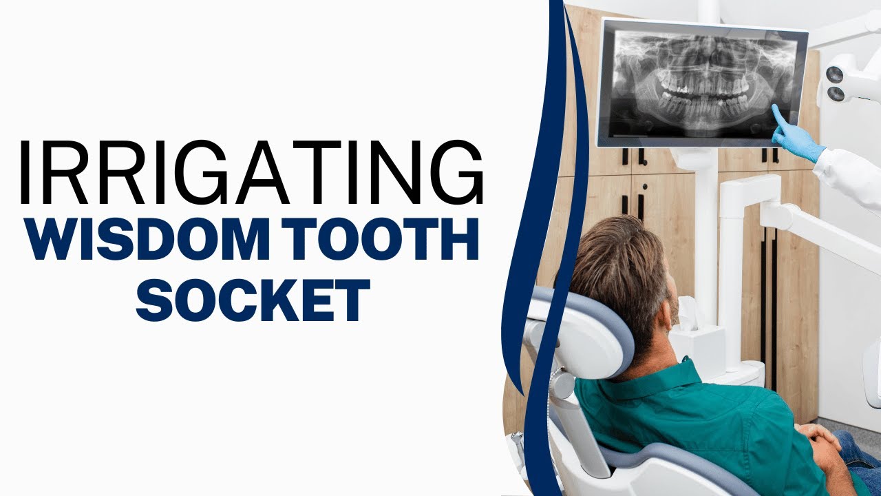 Irrigating Wisdom Tooth Socket: 5 Extraction Complications